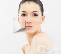 彩光祛痘原理是什么？