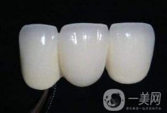 貴金屬烤瓷牙的危害有哪些？