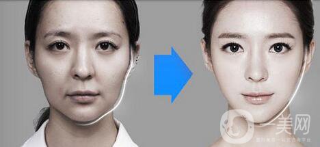 *針瘦臉多少錢 明星都推薦的瘦臉秘籍