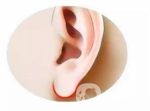 玻尿酸豐耳垂好嗎 相學解析有耳垂才有福氣