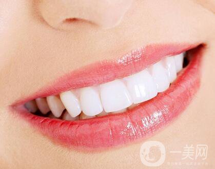 上海種植牙哪里*好？