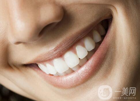 湖州種植牙多少錢一顆？