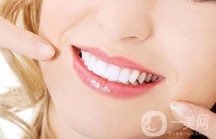 登騰種植牙價格便宜嗎？