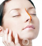 硅膠墊鼻梁多久生包膜？如何避免隆鼻后遺癥？