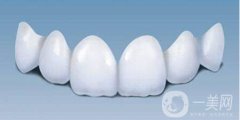 貴金屬烤瓷牙的種類有哪些 分別有那些優(yōu)點