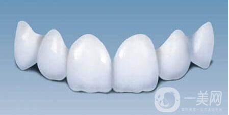 貴金屬烤瓷牙,種類,優(yōu)點