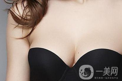 做完乳暈飄紅之后需要多久恢復正常？