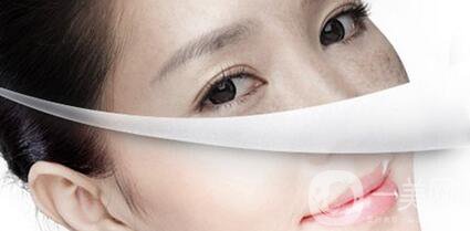 激光嫩膚*果怎么樣?明星擁有白皙肌膚的秘密