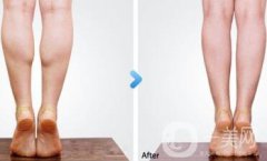 南京注射注射瘦臉注射瘦腿多少錢(qián)