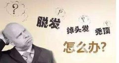 脫發(fā)怎么辦？鄭州植發(fā)醫(yī)院信息介紹？