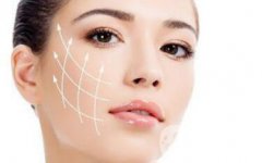 *除皺*嗎？可以維持多久的時(shí)間？