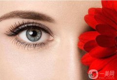 杭州割雙眼皮大概需要多少錢(qián)