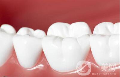 登騰做種植牙多少錢 價(jià)格影響因素詳解