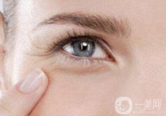 怎么除魚尾紋？有哪些方法？