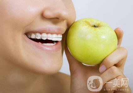 t4a可以矯正牙齒嗎？