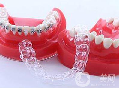 嘉興牙齒矯正價格是多少？