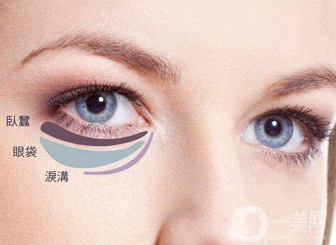 內(nèi)切祛眼袋多久恢復(fù)？