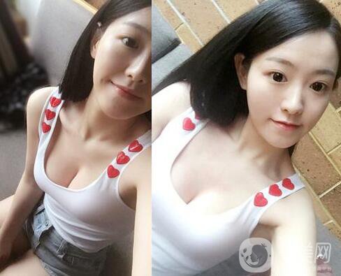 假體隆胸有什么危害？