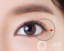 開外眼角風(fēng)險大嗎？