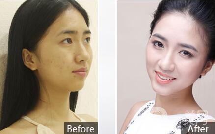 2018湛江華美整形醫(yī)院價格（目）表年終鉅惠版全新一覽