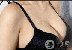 假體隆胸手術(shù)做完之后恢復(fù)期要多久時(shí)間？