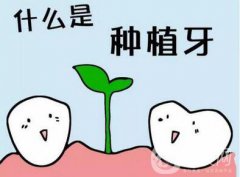 上海九院做一次種植牙價格是多少？價格貴嗎？