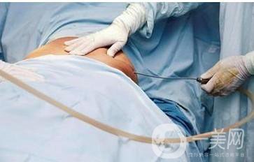 西安抽脂減肥價(jià)格 怎樣擁有好身材