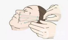 微創(chuàng)面部*手術(shù)價(jià)格是多少