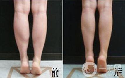 *的副作用有哪些？