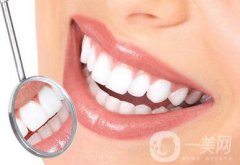 *潔牙多少錢一次？