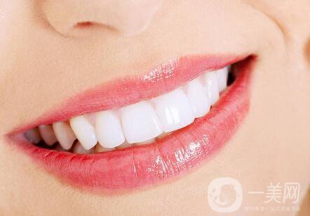 *潔牙多少錢一次？