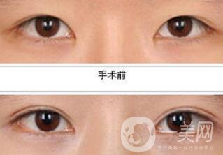 *都包含哪些項目？*整形多少錢