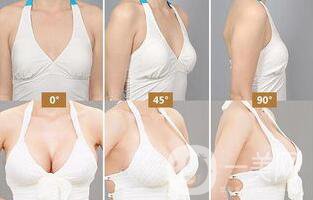 自體隆胸后多久可以上班？術(shù)后有哪些注意事項