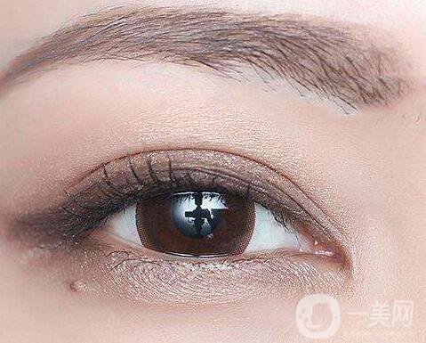 割雙眼皮術(shù)后注意事項(xiàng)有哪些？