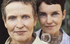 上海做微創(chuàng)面部提升手術(shù) 參考價(jià)格是多少