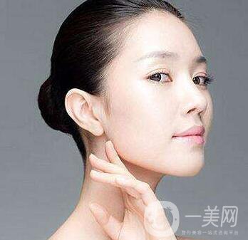 怎么減雙下巴？抽脂減雙下巴怎么樣？