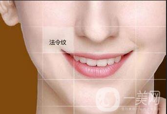臉上長(zhǎng)法令紋怎么才能祛除 方法介紹