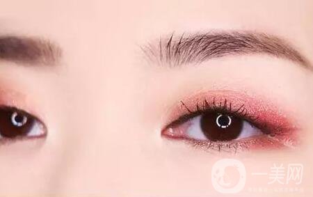 全切雙眼皮肉條多久消？