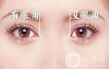 北京,開(kāi)眼角