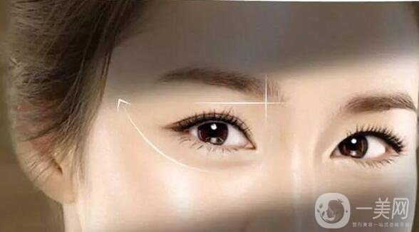 開(kāi)眼角,風(fēng)險(xiǎn)