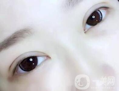 埋線后注意事項(xiàng)有哪些？