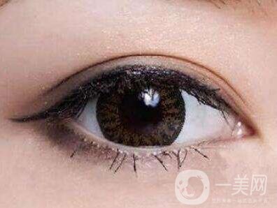 埋線雙眼皮要拆線嗎？如何護(hù)理？