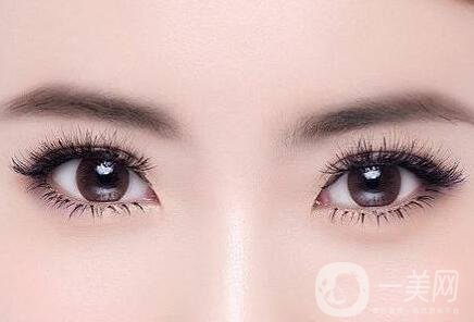 埋線雙眼皮術(shù)后護理有哪些？