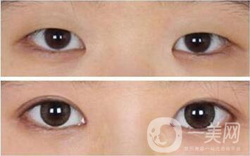 *整形主要都包含哪些項(xiàng)目