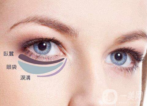 內(nèi)切眼袋真實恢復過程，術(shù)后注意事項