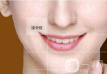 自體脂肪豐鼻唇溝,*果,術(shù)后護(hù)理