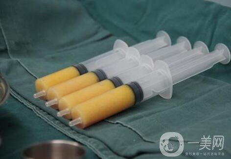 自體脂肪隆胸后多久可以恢復上班？