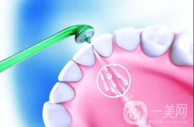超聲波潔牙*果 注意事項主要有哪些