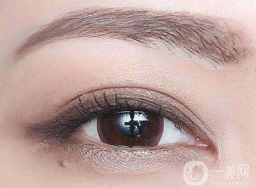 全切雙眼皮能維持多久？