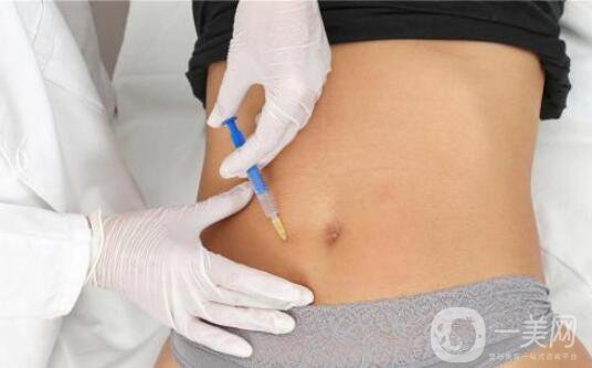 肥胖紋怎么消除 消除肥胖紋的方法